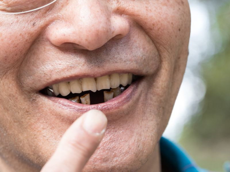 The Most Common Problems Dentists Are Seeing As A Result Of The Pandemic